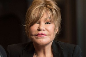 A Picture of Jocelyn Wildenstein